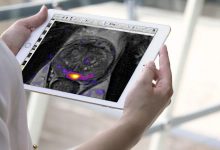how-artificial-intelligence-can-help-your-prostate-gland