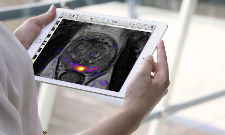 how-artificial-intelligence-can-help-your-prostate-gland